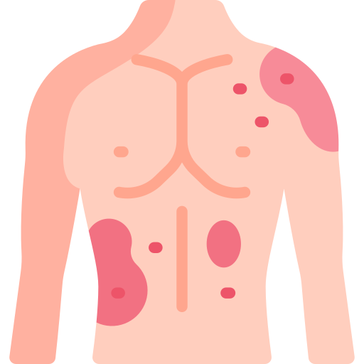 Chest Diseases